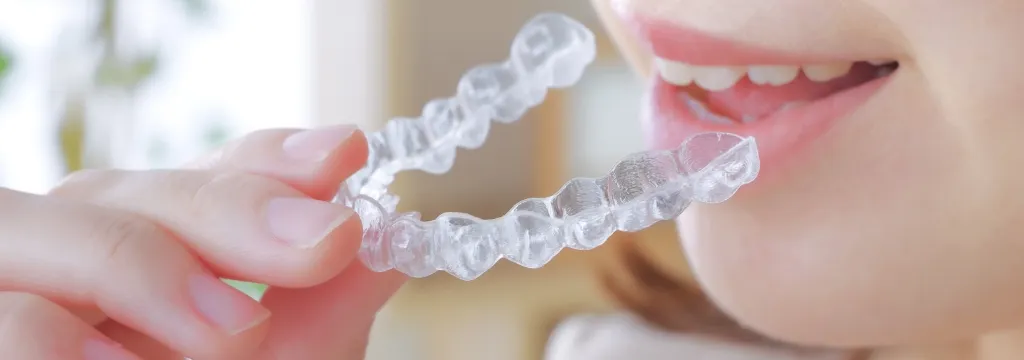 マウスピース型矯正装置「インビザライン」はこんな方におすすめです
