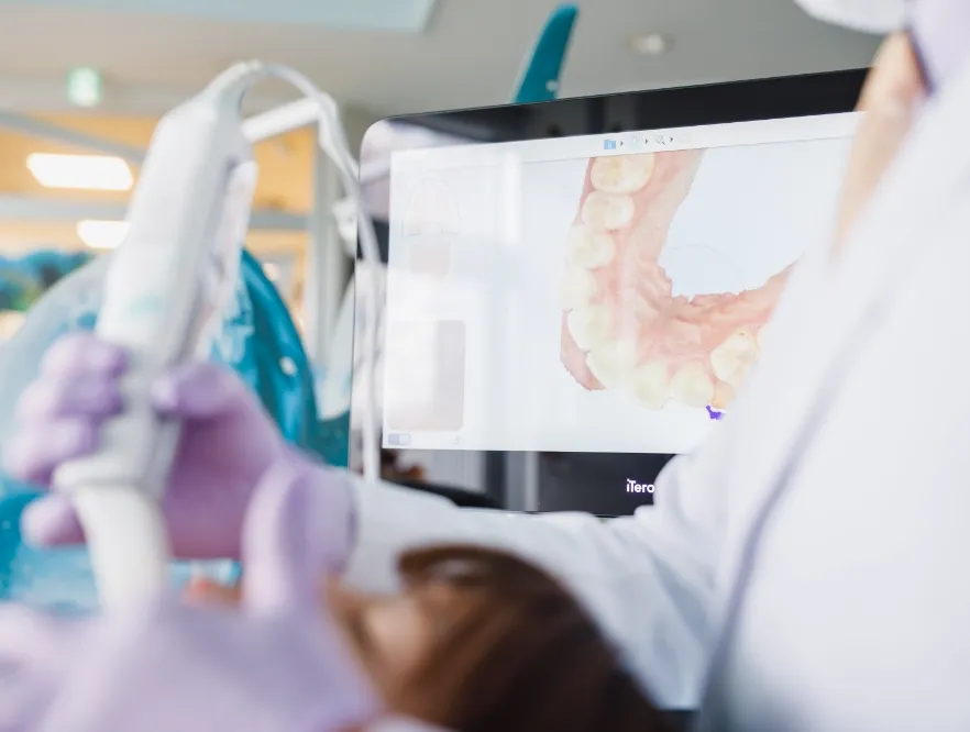 歯の移動シミュレーション