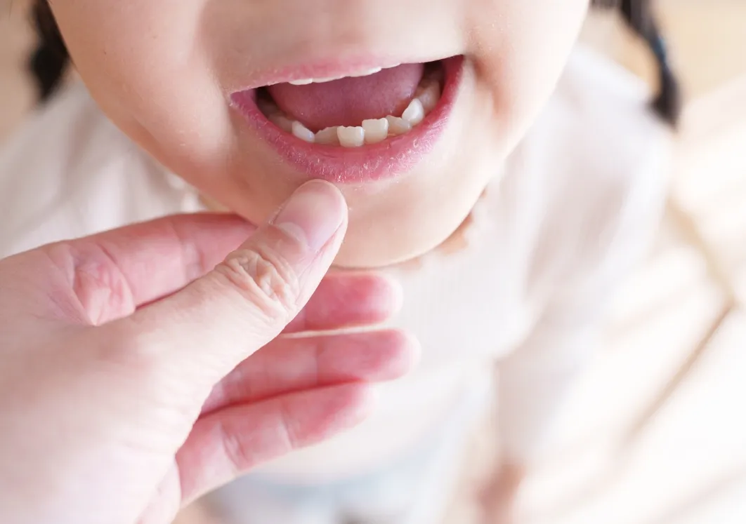 将来の「抜歯」リスクを減らせる